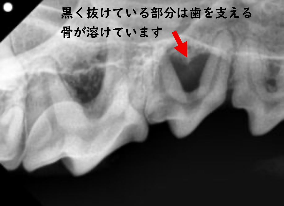 レントゲン写真
