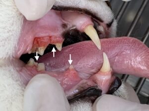破歯細胞性吸収病巣