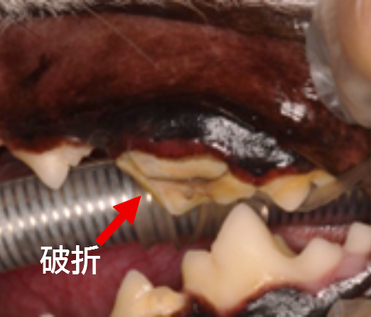 抜歯 症例1