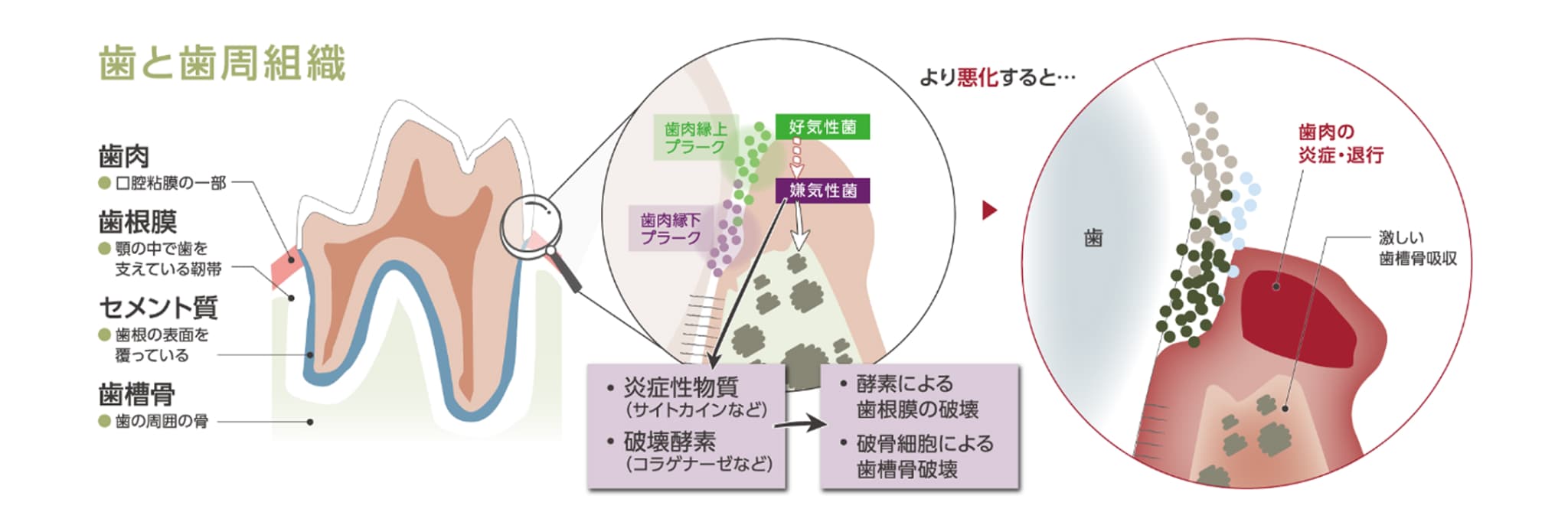 歯と歯周組織