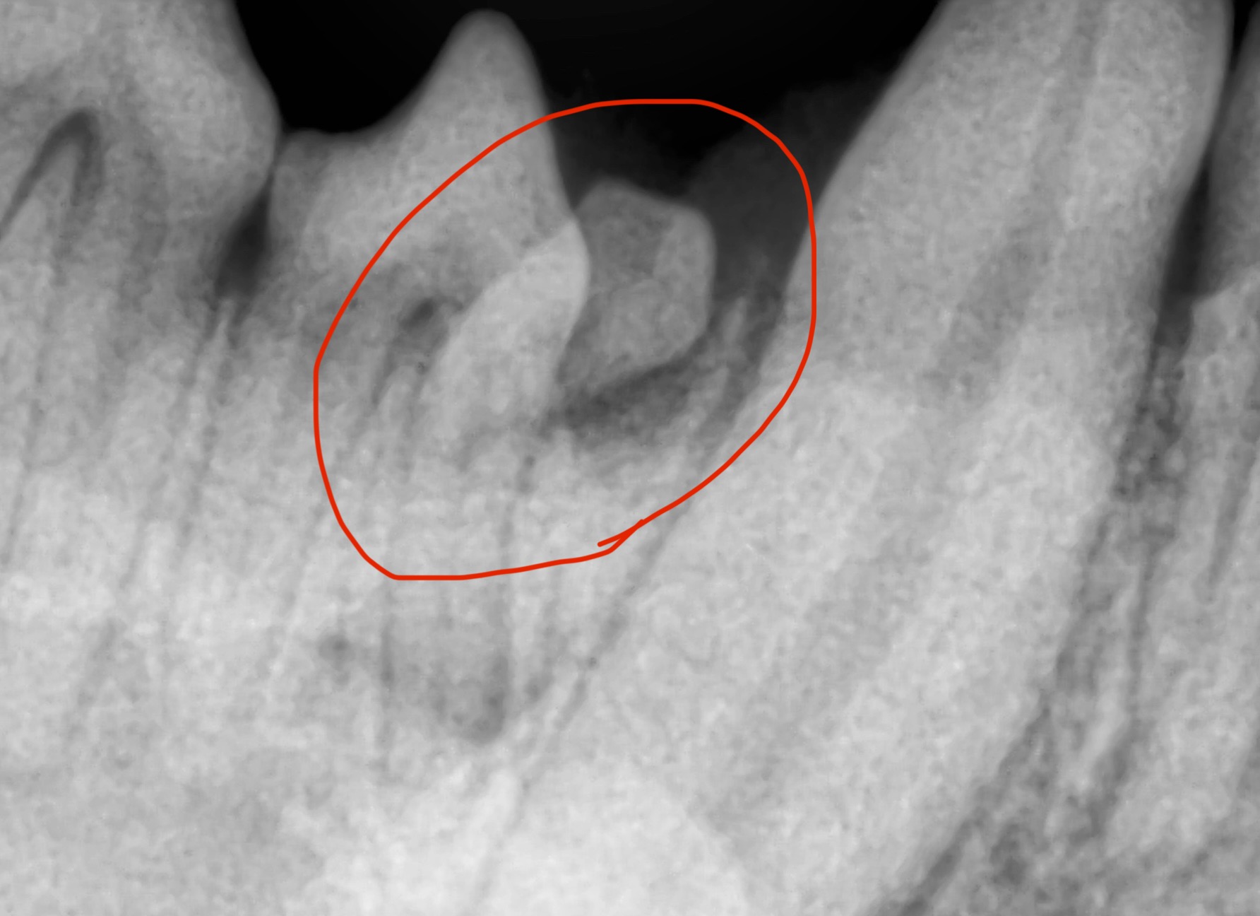 【歯科症例】下顎の埋伏歯の抜歯を行ったワンちゃん